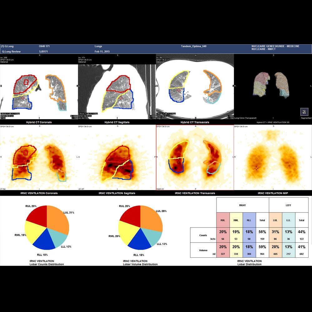 Оборудование ядерной медицины GE Healthcare NM/CT 850