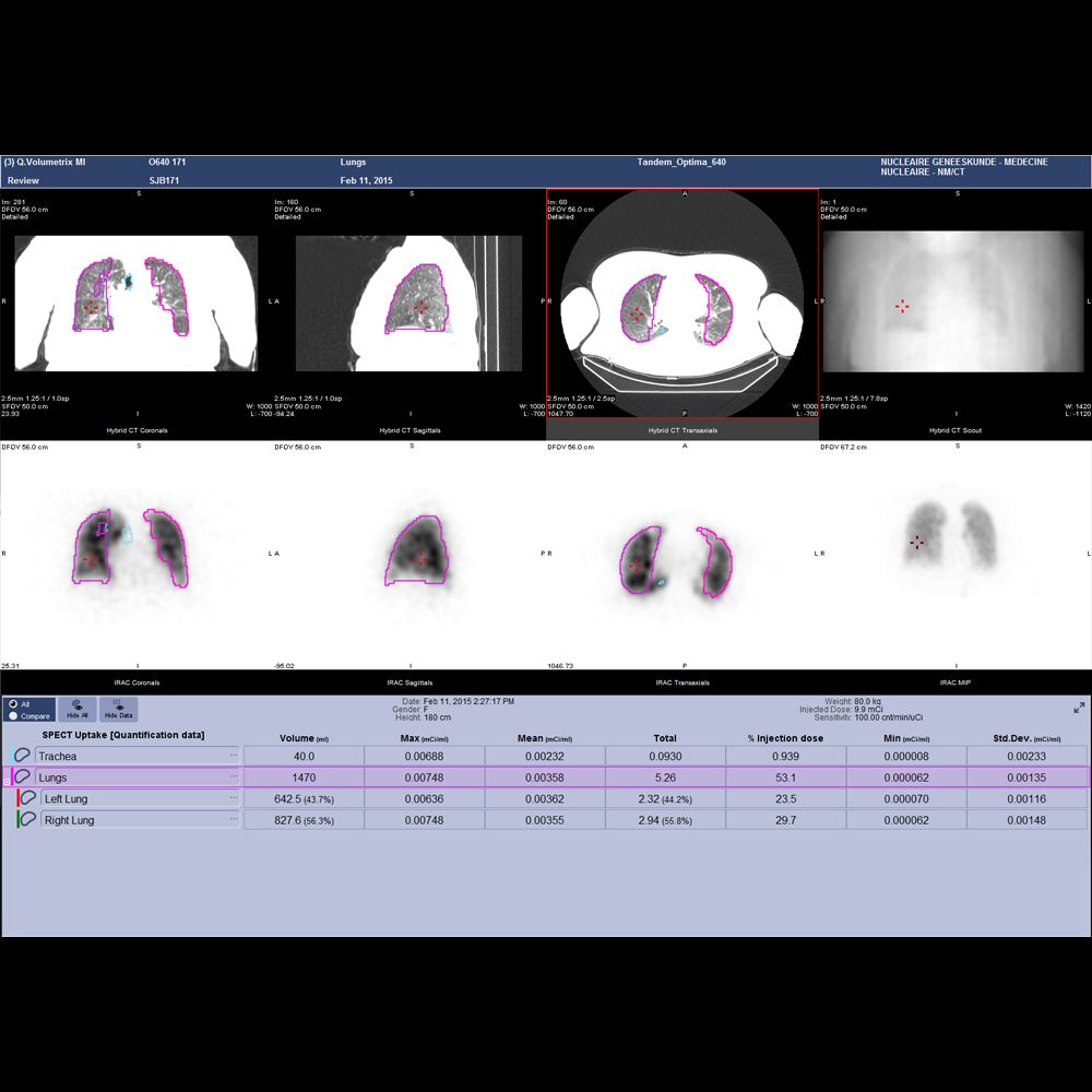 Оборудование ядерной медицины GE Healthcare NM/CT 850